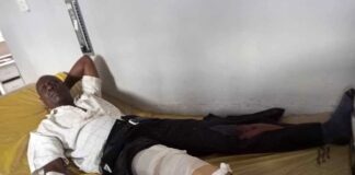 Regional Police Commander Sustains Injuries in Swift bus suspected bomb blast